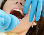Удаление зубов: особенности, показания, противопоказания